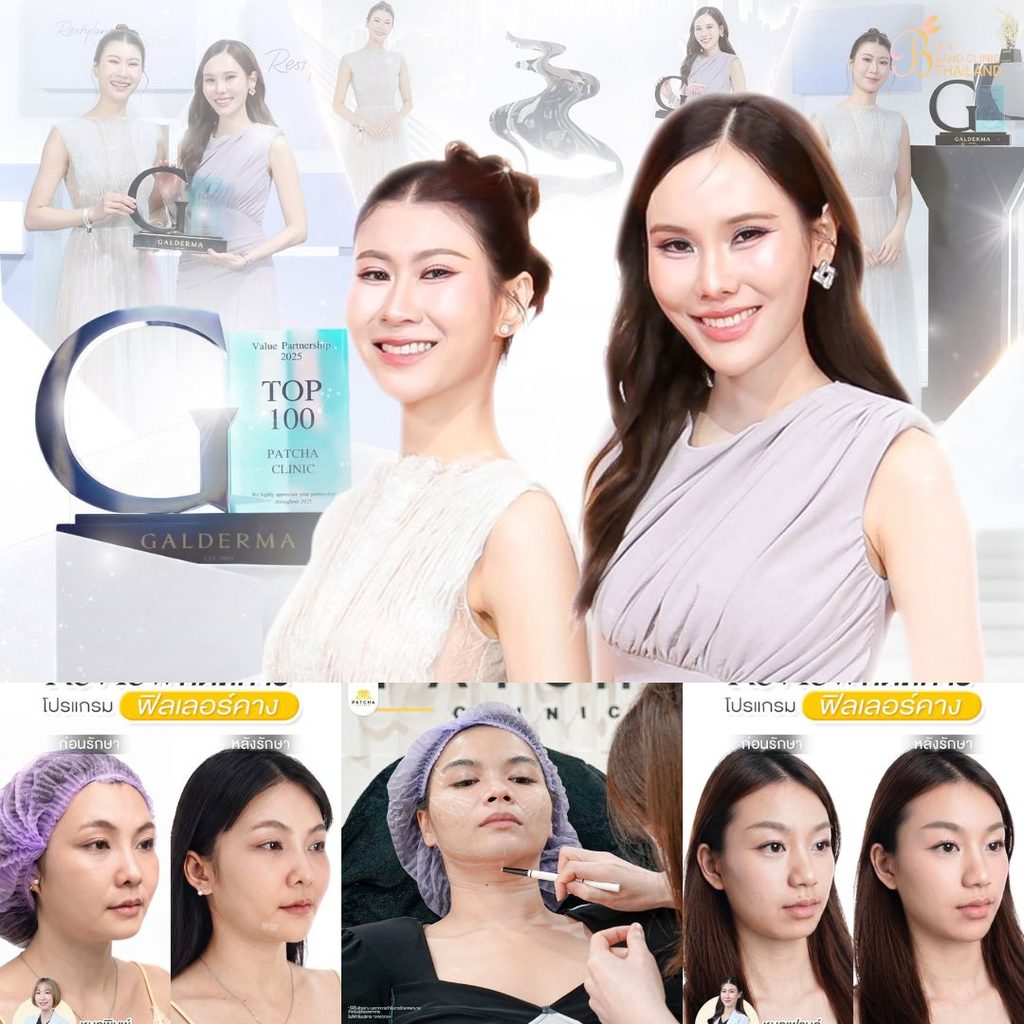 ฉีดฟิลเลอร์คางที่ Patcha Clinic
