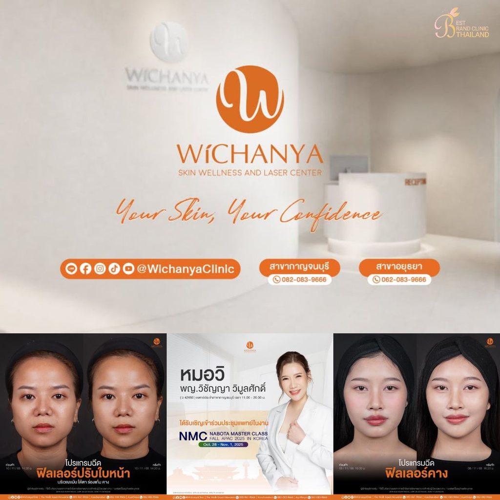 ฉีดฟิลเลอร์คางที่ Wichanya Clinic