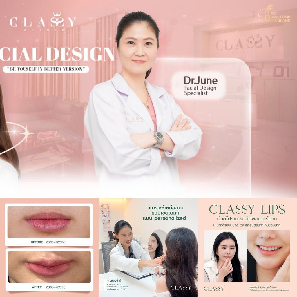 ฉีดฟิลเลอร์ปากที่ Classy Clinic
