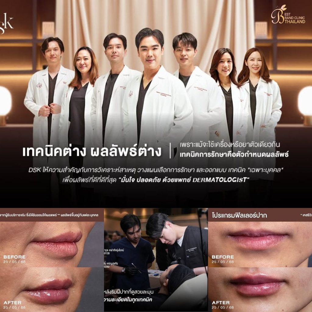 ฉีดฟิลเลอร์ปากที่ DKS Clinic