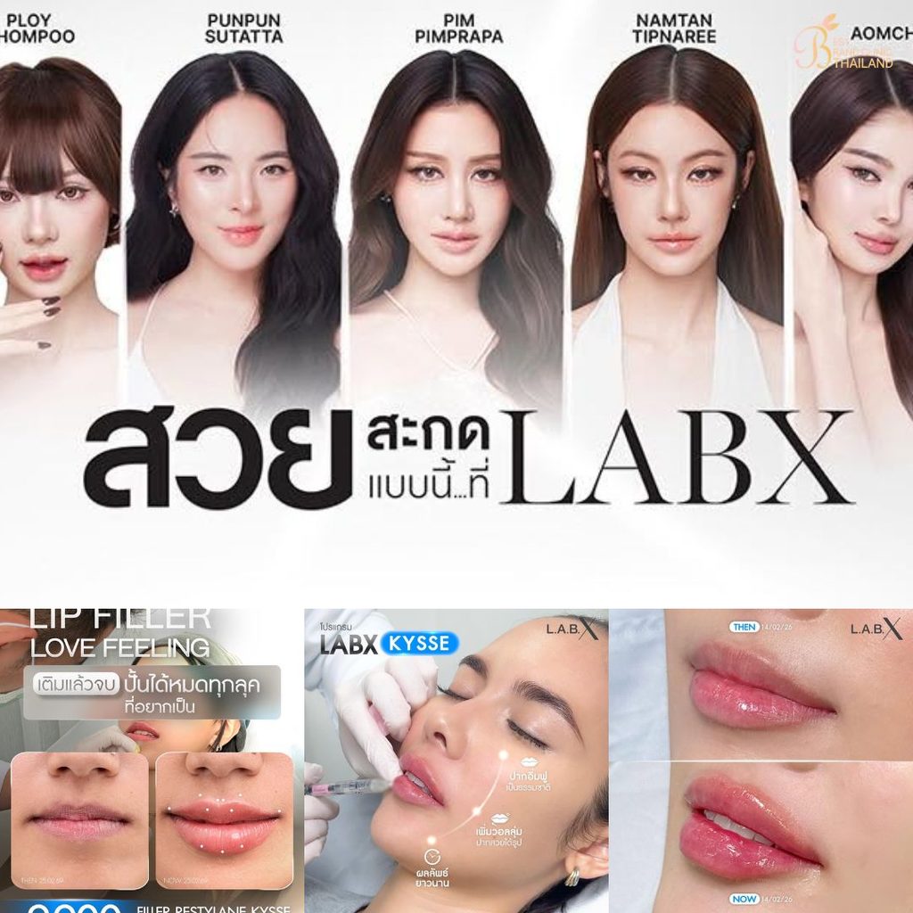 ฉีดฟิลเลอร์ปากที่ LabX Clinic