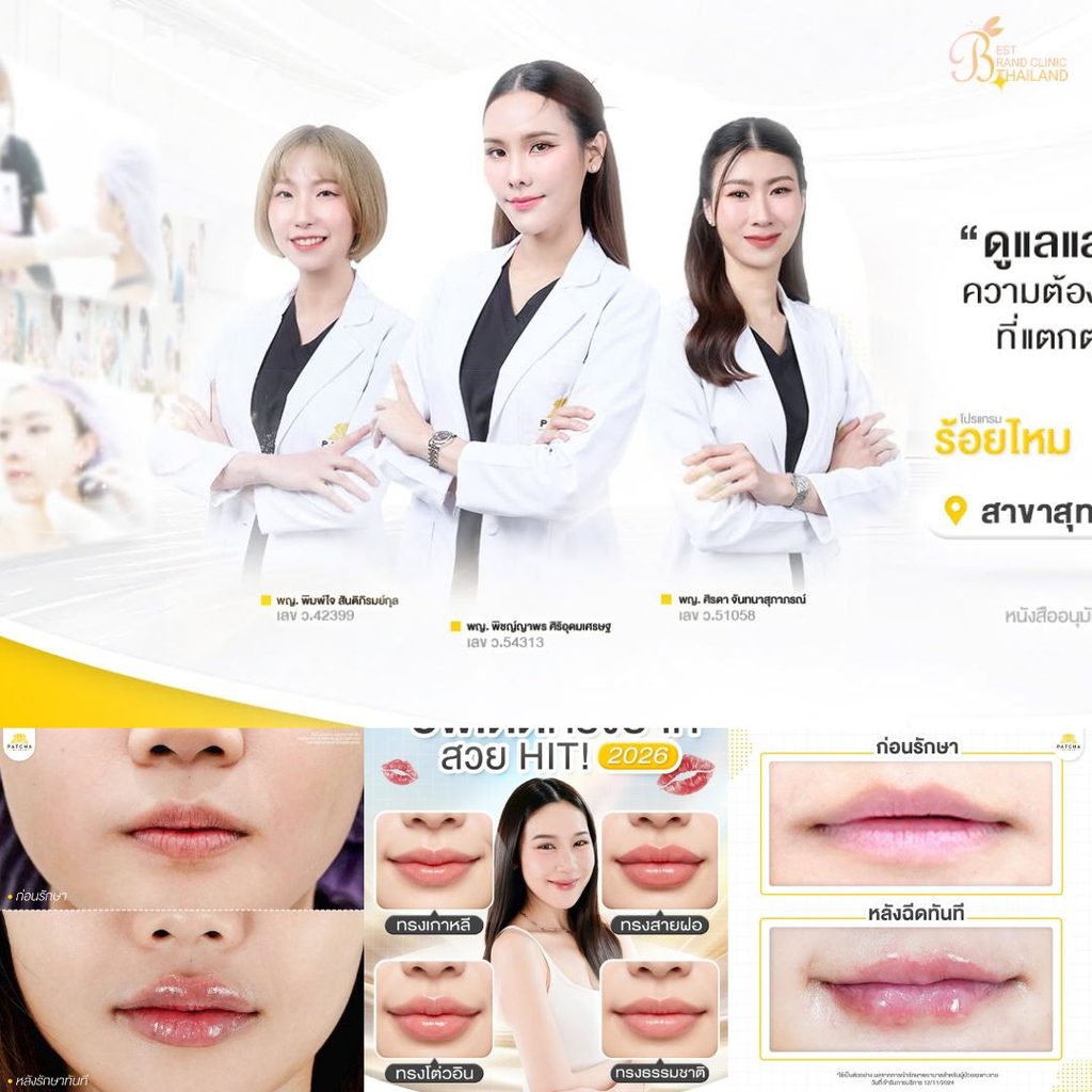ฉีดฟิลเลอร์ปากที่ Patcha Clinic