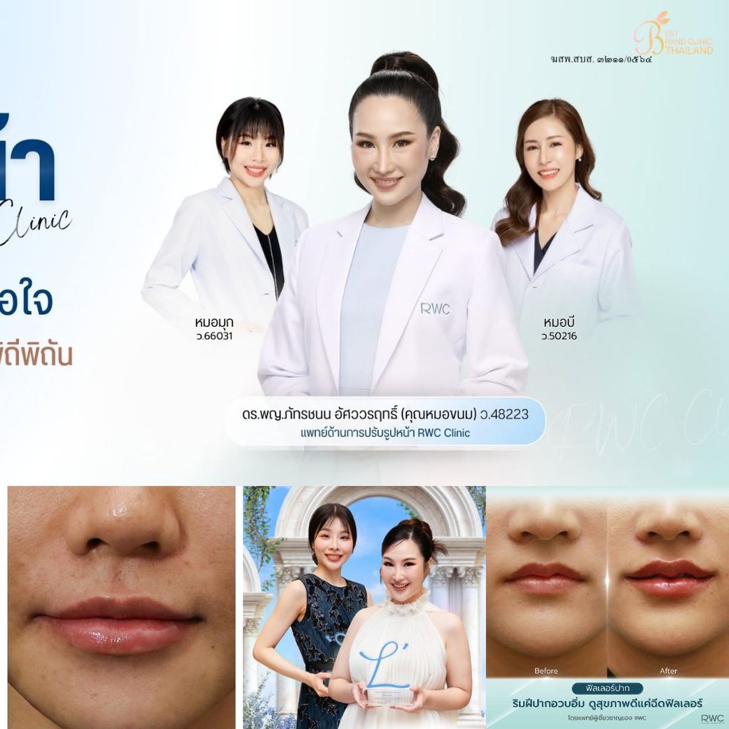 ฉีดฟิลเลอร์ปากที่ RWC Clinic