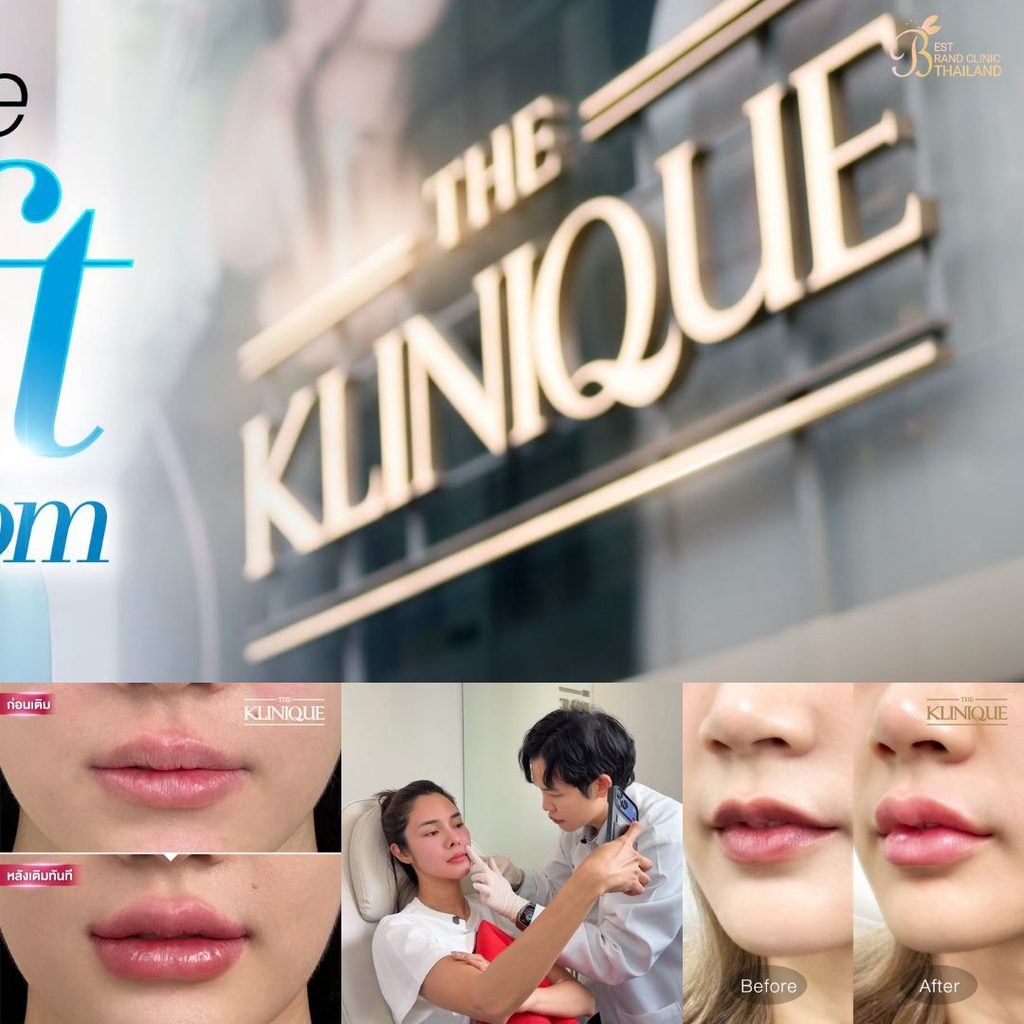 ฉีดฟิลเลอร์ปากที่ THE KLINIQUE
