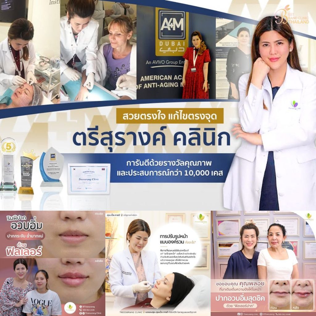 ฉีดฟิลเลอร์ปากที่ Treesurang Clinic