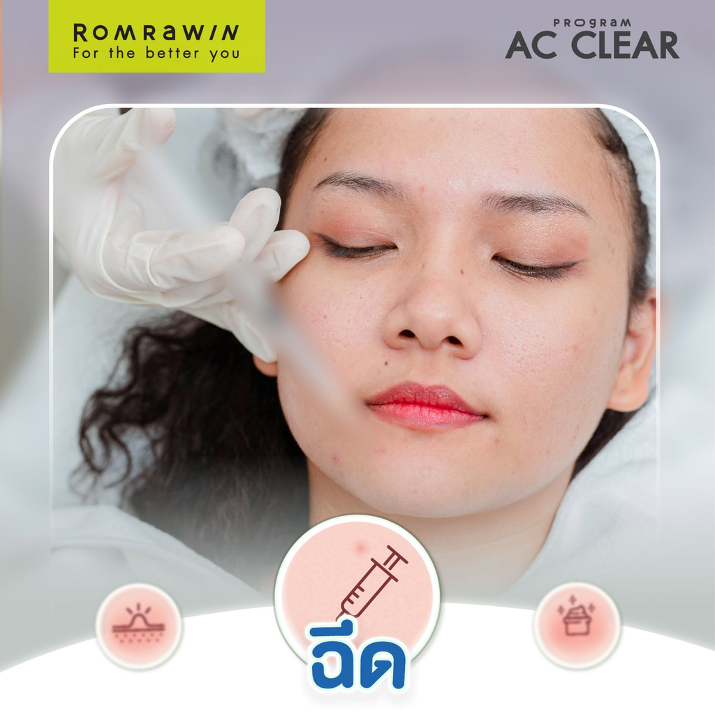 รีวิวรักษาสิวที่ Romrawin Clinic