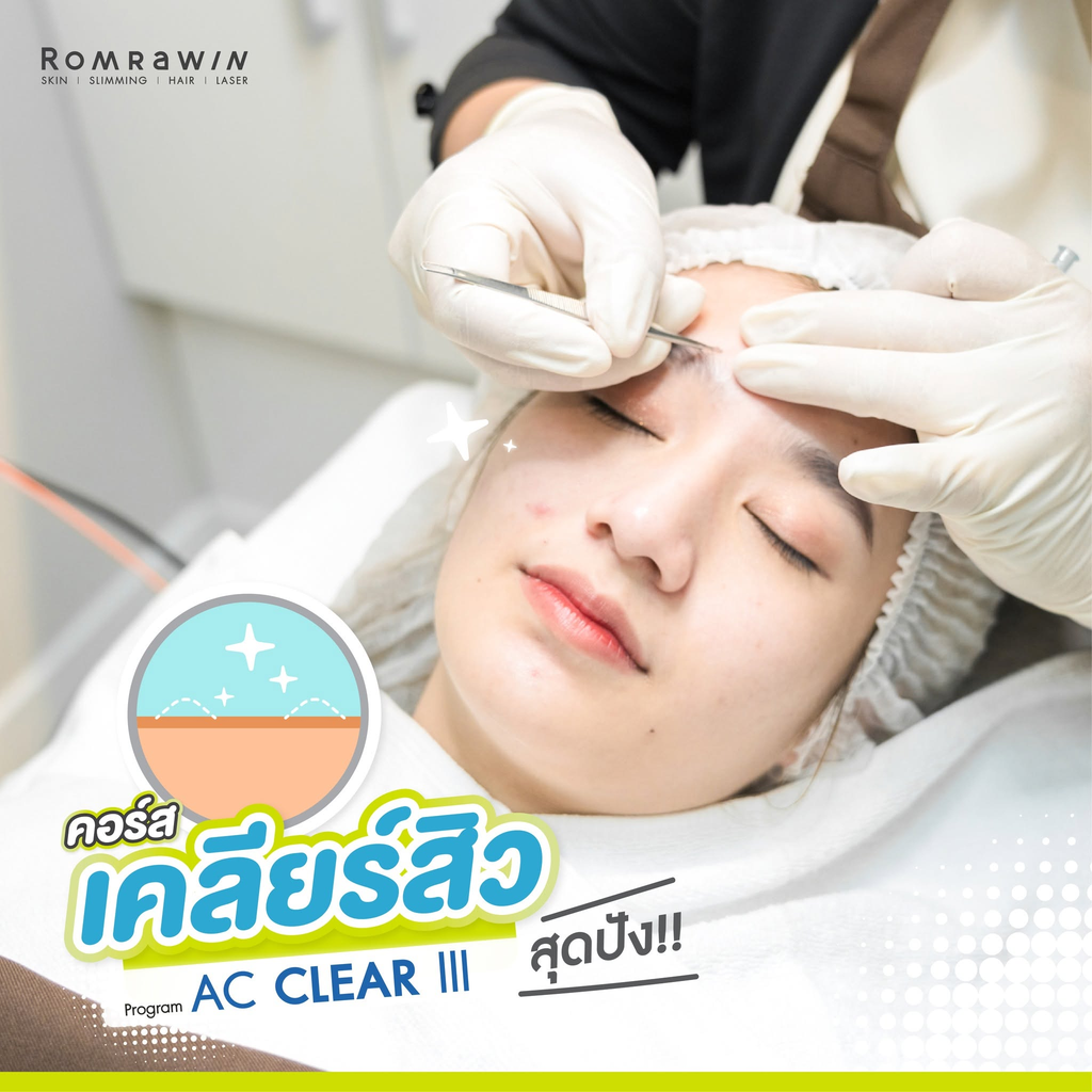 รีวิวรักษาสิวที่ Romrawin Clinic