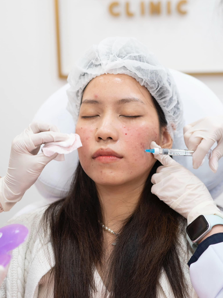 รีวิวรักษาสิวที่ Mega Clinic