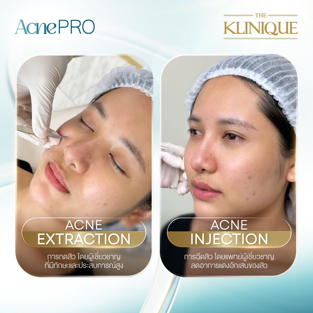 รีวิวรักษาสิวที่ THE KLINIQUE Clinic