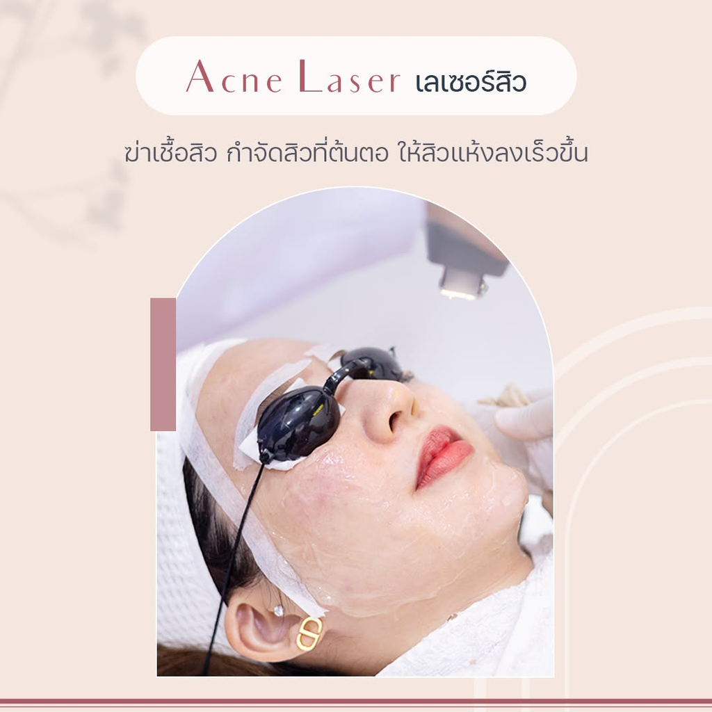 รีวิวรักษาสิวที่ Blossom Clinic