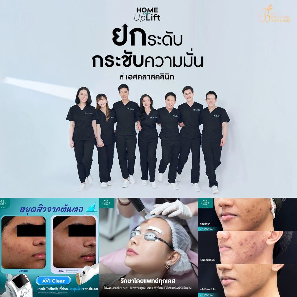 รักษาสิวที่ AES CLASS Clinic