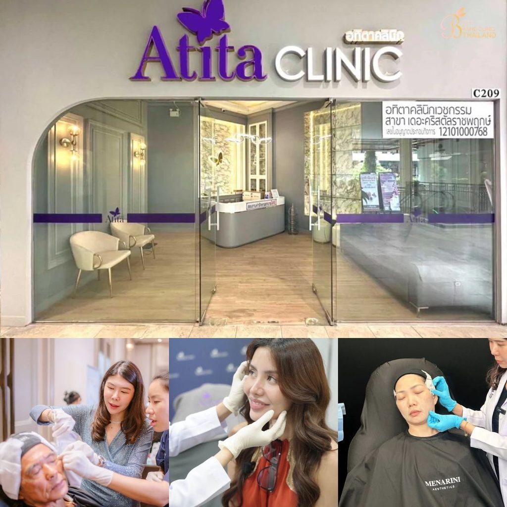 รักษาสิวที่ Atita Clinic