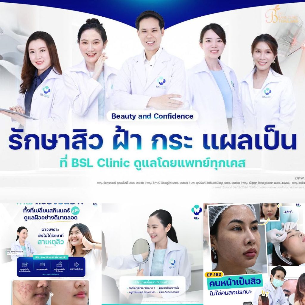 รักษาสิวที่ BSL Clinic
