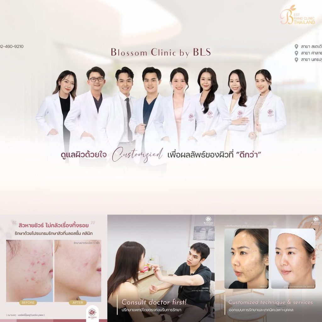 รักษาสิวที่ Blossom Clinic