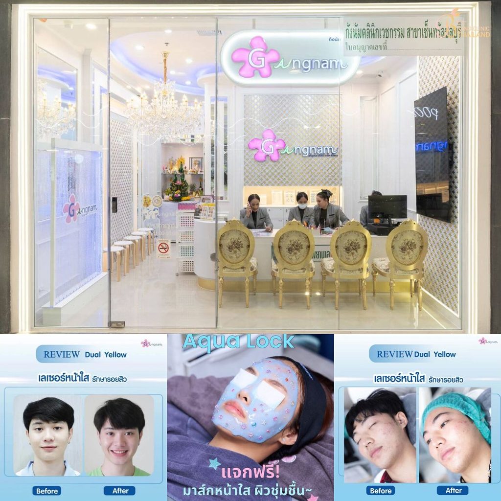 รักษาสิวที่ Gangnam Clinic