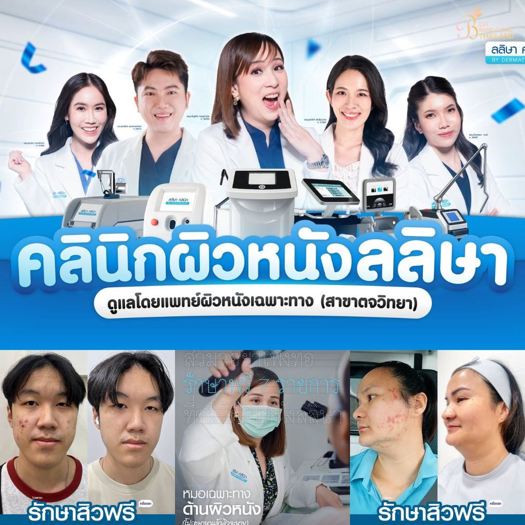 รักษาสิวที่ LALIZA Clinic