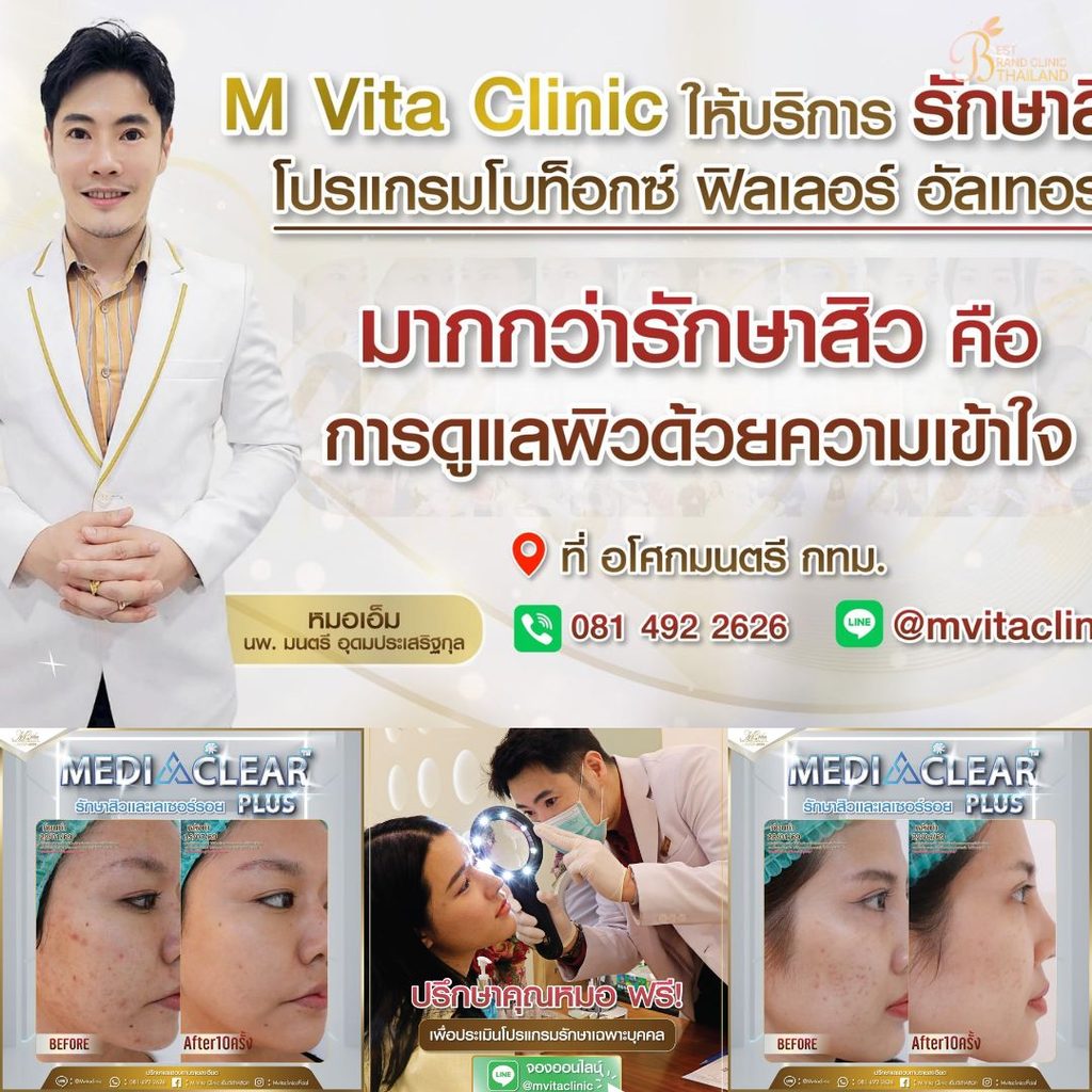 รักษาสิวที่ M Vita Clinic