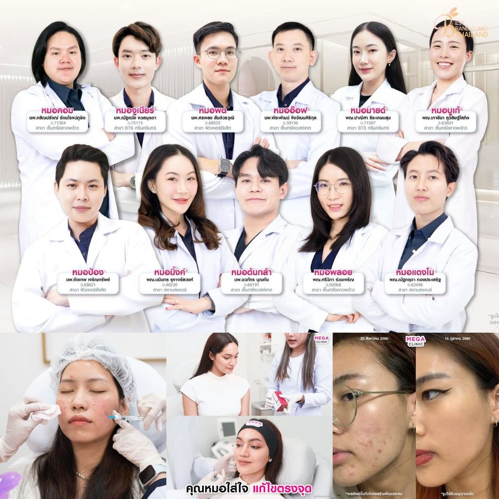 รักษาสิวที่ Mega Clinic
