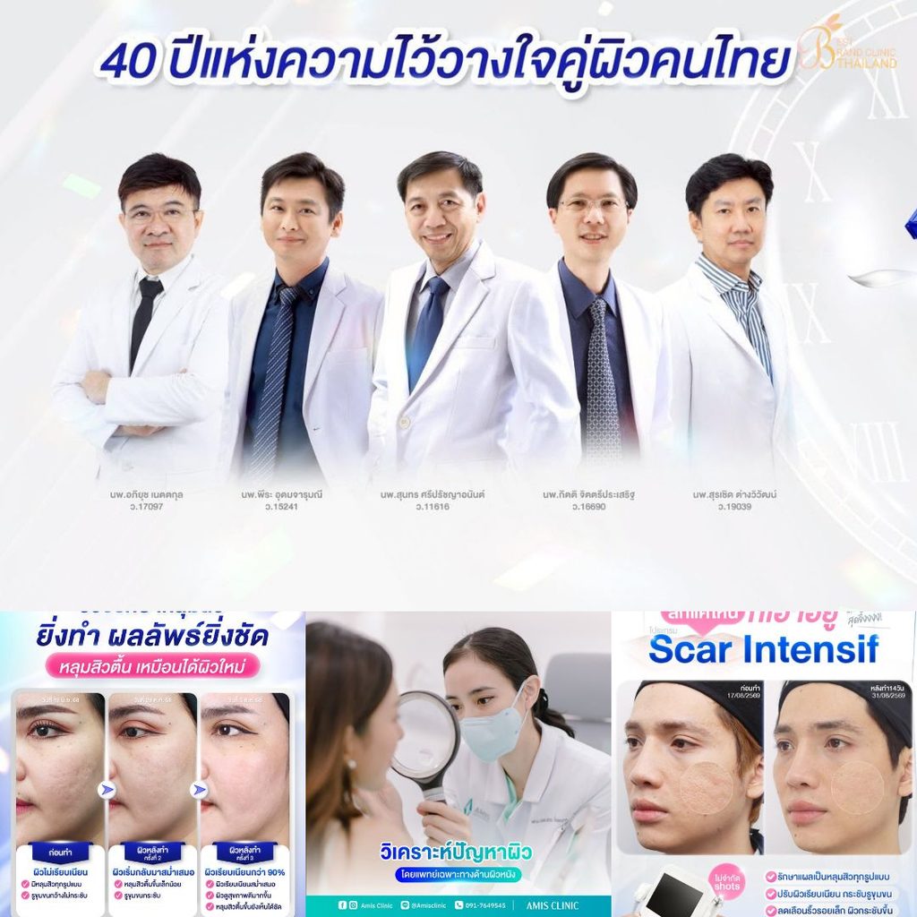 รักษาสิวที่ Pornkasem Clinic