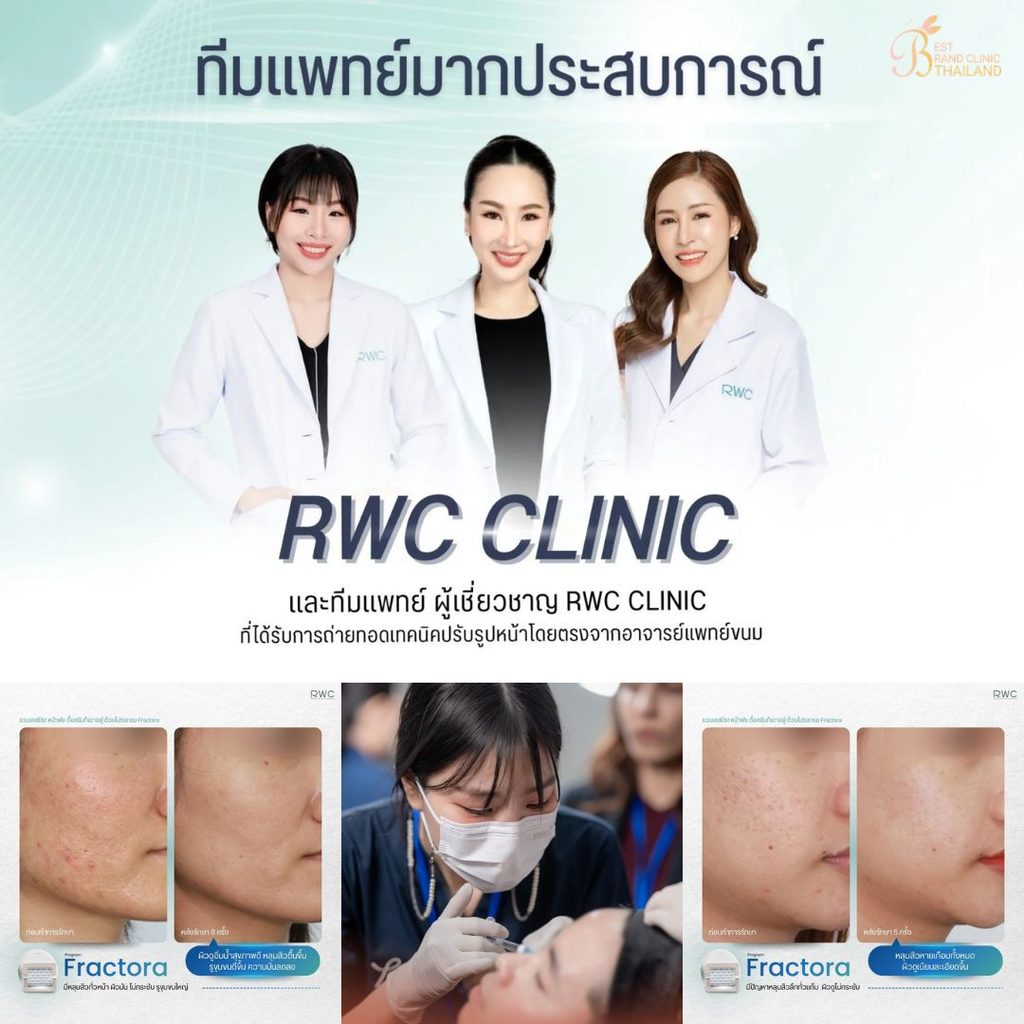 รักษาสิวที่ RWC Clinic