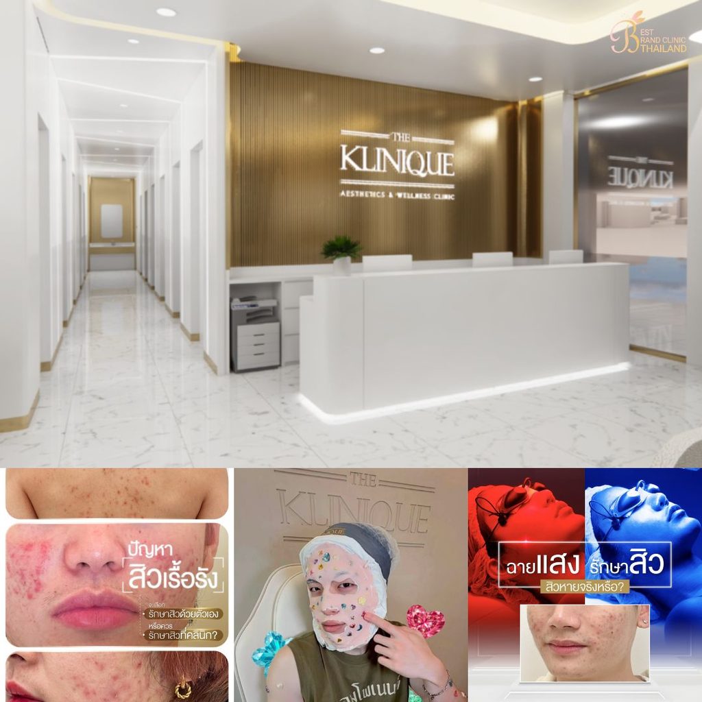 รักษาสิวที่ THE KLINIQUE Clinic