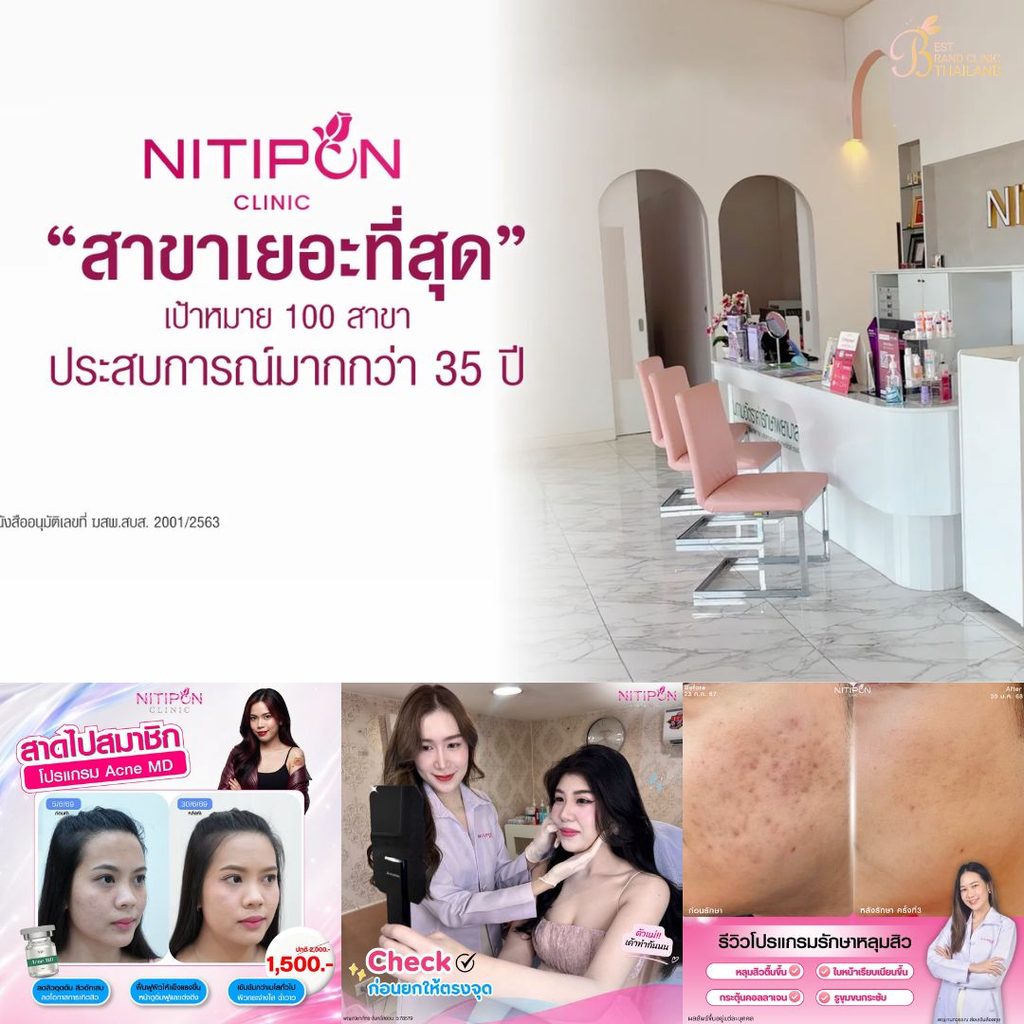 รักษาสิวที่ นิติพลคลินิก